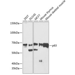 p63 Rabbit mAb