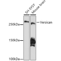 Versican Rabbit mAb