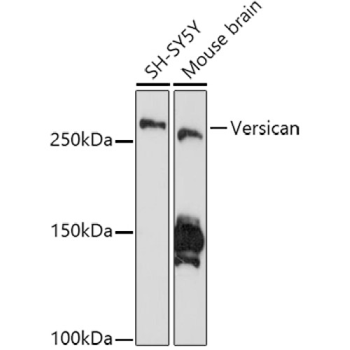 Versican Rabbit mAb