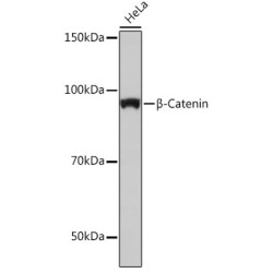 [KO Validated] β-Catenin Rabbit mAb