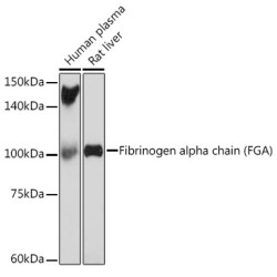 Fibrinogen alpha chain (FGA) Rabbit mAb