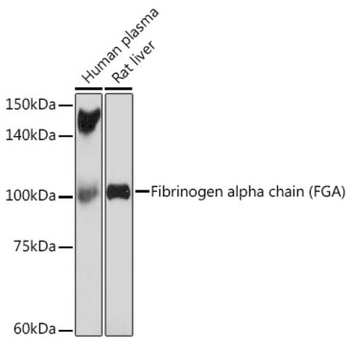 Fibrinogen alpha chain (FGA) Rabbit mAb