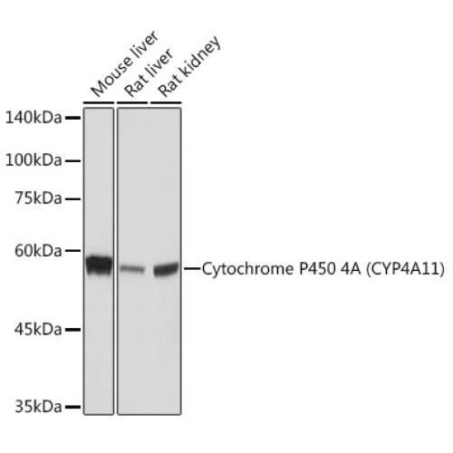 Cytochrome P450 4A (CYP4A11) Rabbit mAb