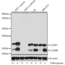 [KD Validated] LC3B Rabbit mAb
