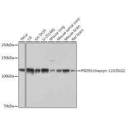 PSD93/chapsyn-110/DLG2 Rabbit mAb