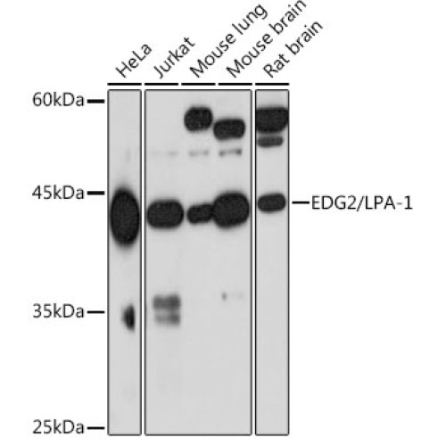 EDG2/LPA-1 Rabbit mAb