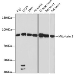 Mitofusin 2 Rabbit mAb