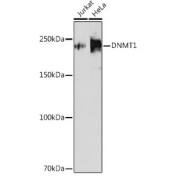 [KD Validated] DNMT1 Rabbit mAb
