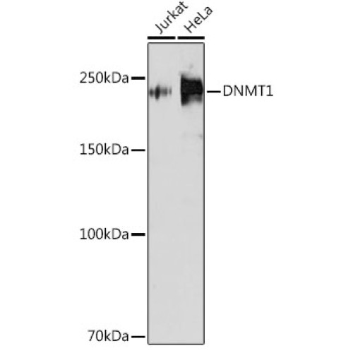[KD Validated] DNMT1 Rabbit mAb
