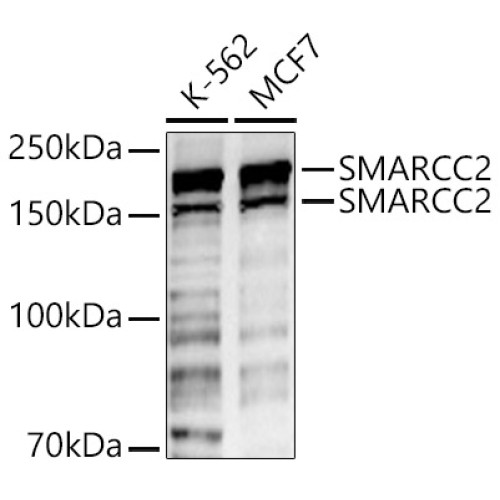 SMARCC2 Rabbit pAb