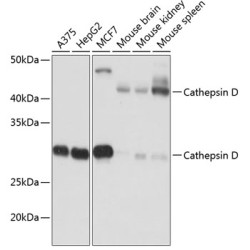 Cathepsin D Rabbit mAb