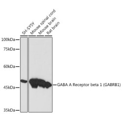 GABA A Receptor beta 1 (GABRB1) Rabbit mAb