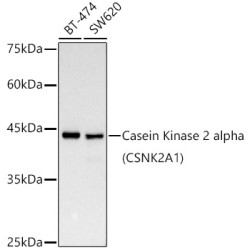[KD Validated] Casein Kinase 2 alpha (CSNK2A1) Rabbit mAb