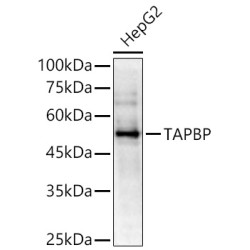 TAPBP Rabbit pAb