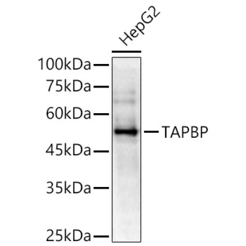 TAPBP Rabbit pAb