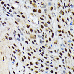 ENT2/SLC29A2 Rabbit mAb