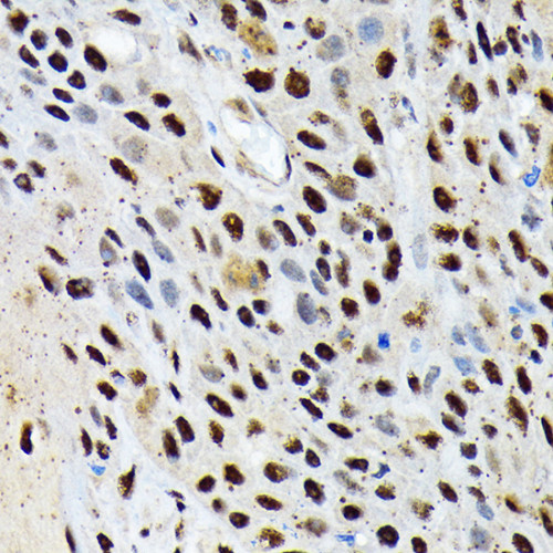 ENT2/SLC29A2 Rabbit mAb