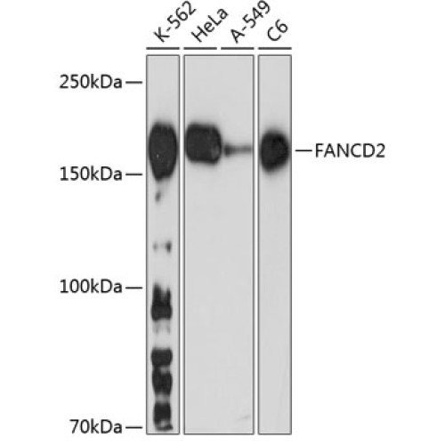 FANCD2 Rabbit mAb