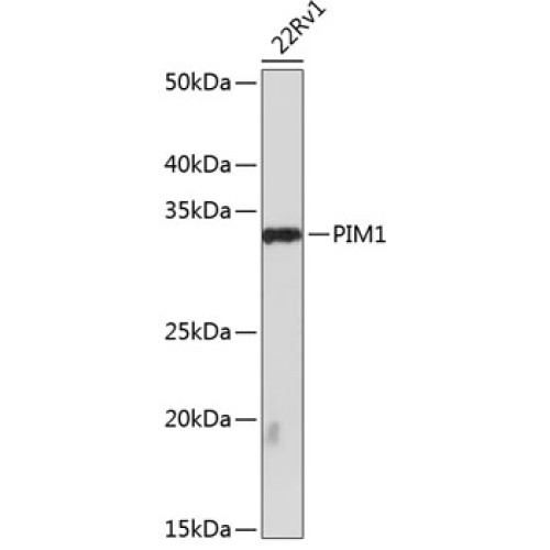 PIM1 Rabbit mAb