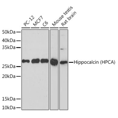 Hippocalcin (HPCA) Rabbit mAb