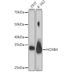 HOXB4 Rabbit mAb