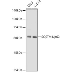 SQSTM1/p62 Rabbit mAb