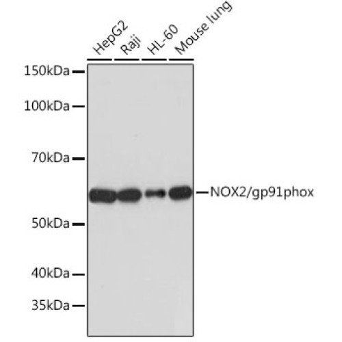 NOX2/gp91phox Rabbit mAb