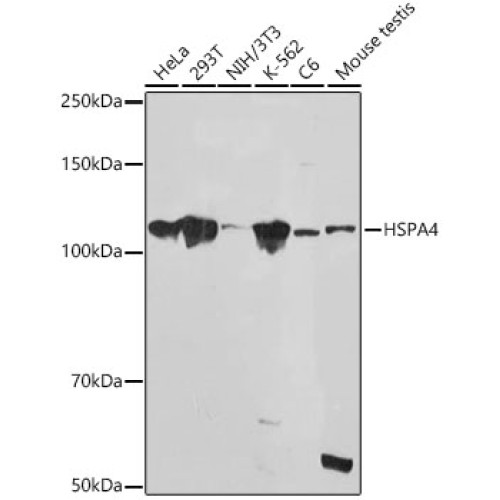 HSPA4 Rabbit mAb