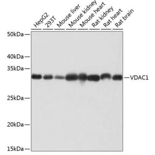 VDAC1 Rabbit mAb