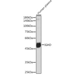 IGHD Rabbit mAb
