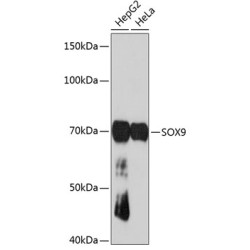 SOX9 Rabbit mAb