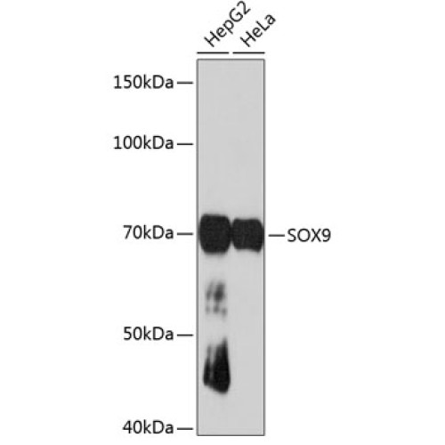 SOX9 Rabbit mAb