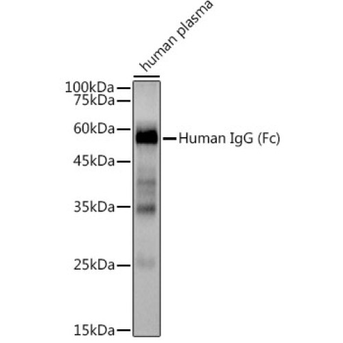 Human IgG Rabbit mAb