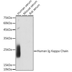 Human Ig Kappa Chain Rabbit mAb