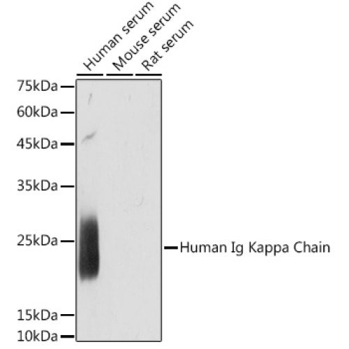 Human Ig Kappa Chain Rabbit mAb