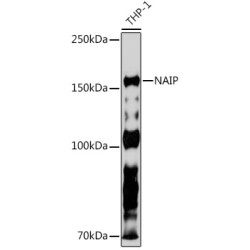 NAIP Rabbit mAb