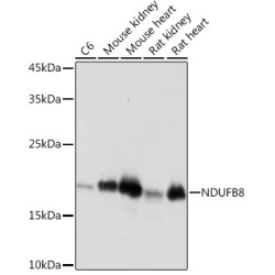 NDUFB8 Rabbit mAb