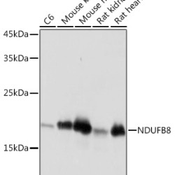 NDUFB8 Rabbit mAb