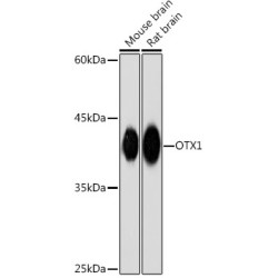 OTX1 Rabbit mAb
