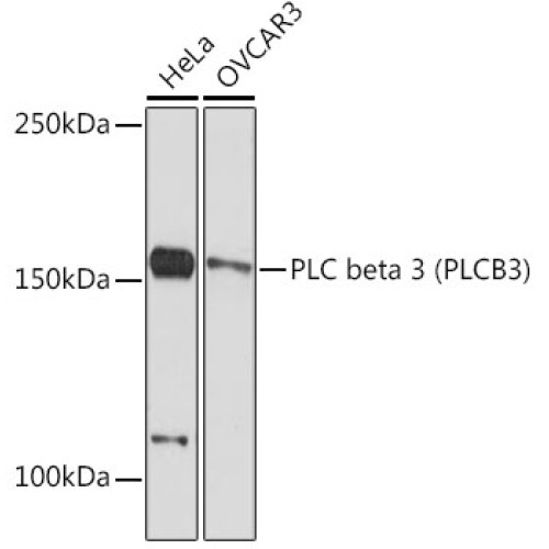PLC beta 3 (PLCB3) Rabbit mAb