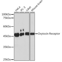 Oxytocin Receptor Rabbit mAb