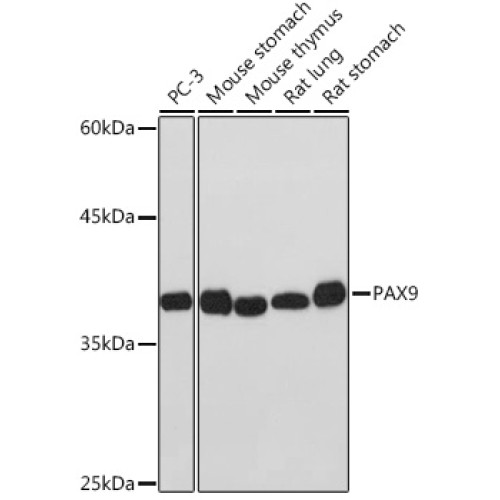 PAX9 Rabbit mAb