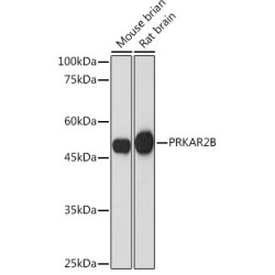 PRKAR2B Rabbit mAb