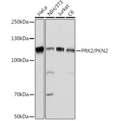 PRK2/PKN2 Rabbit mAb