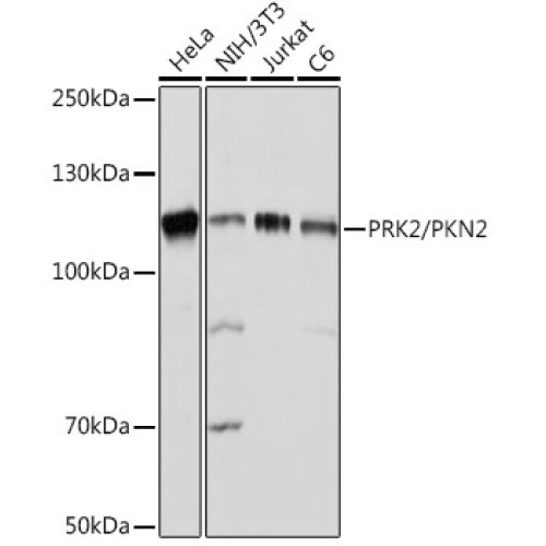 PRK2/PKN2 Rabbit mAb