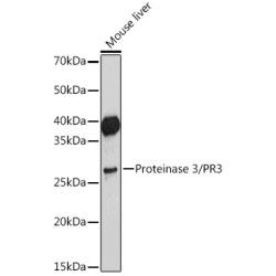 Proteinase 3/PR3 Rabbit mAb