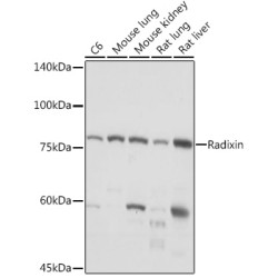 Radixin Rabbit mAb