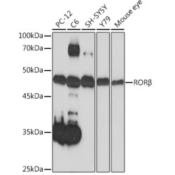 RORβ Rabbit mAb