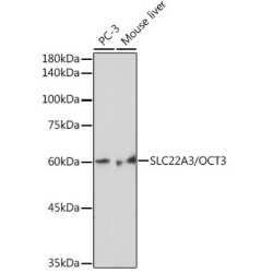SLC22A3/OCT3 Rabbit mAb