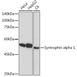 Syntrophin alpha 1 Rabbit mAb